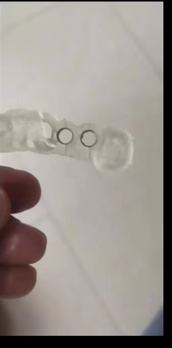 レジンデンタルプリンター,植栽ガイド,高精度の硬さ,uv次元 - 3D Printing Guide のレビューと価格